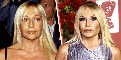 donatella versace before and after plastic surgery|donatella versace without plastic surgery.